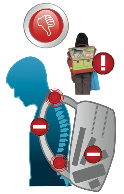 Incorrect backpack adjustment
